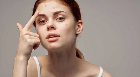 Say Goodbye to Acne and Wrinkles: The Niacinamide Serum That Does It All!