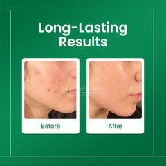 Niacinamide Serum