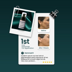 Exoderm Serum