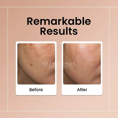 Radiance Day Cream - Skin Sciences