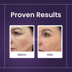 Retinol Serum - Skin Sciences