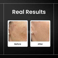 TxA Serum - Skin Sciences