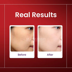 Alpha Arbutin Serum