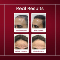 Exosome Skin & Hair Bundle