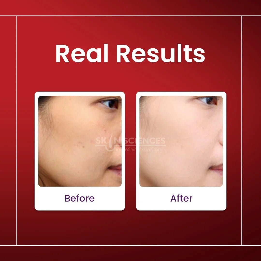 Alpha Arbutin Serum - Skin Sciences