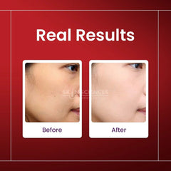Alpha Arbutin Serum - Skin Sciences