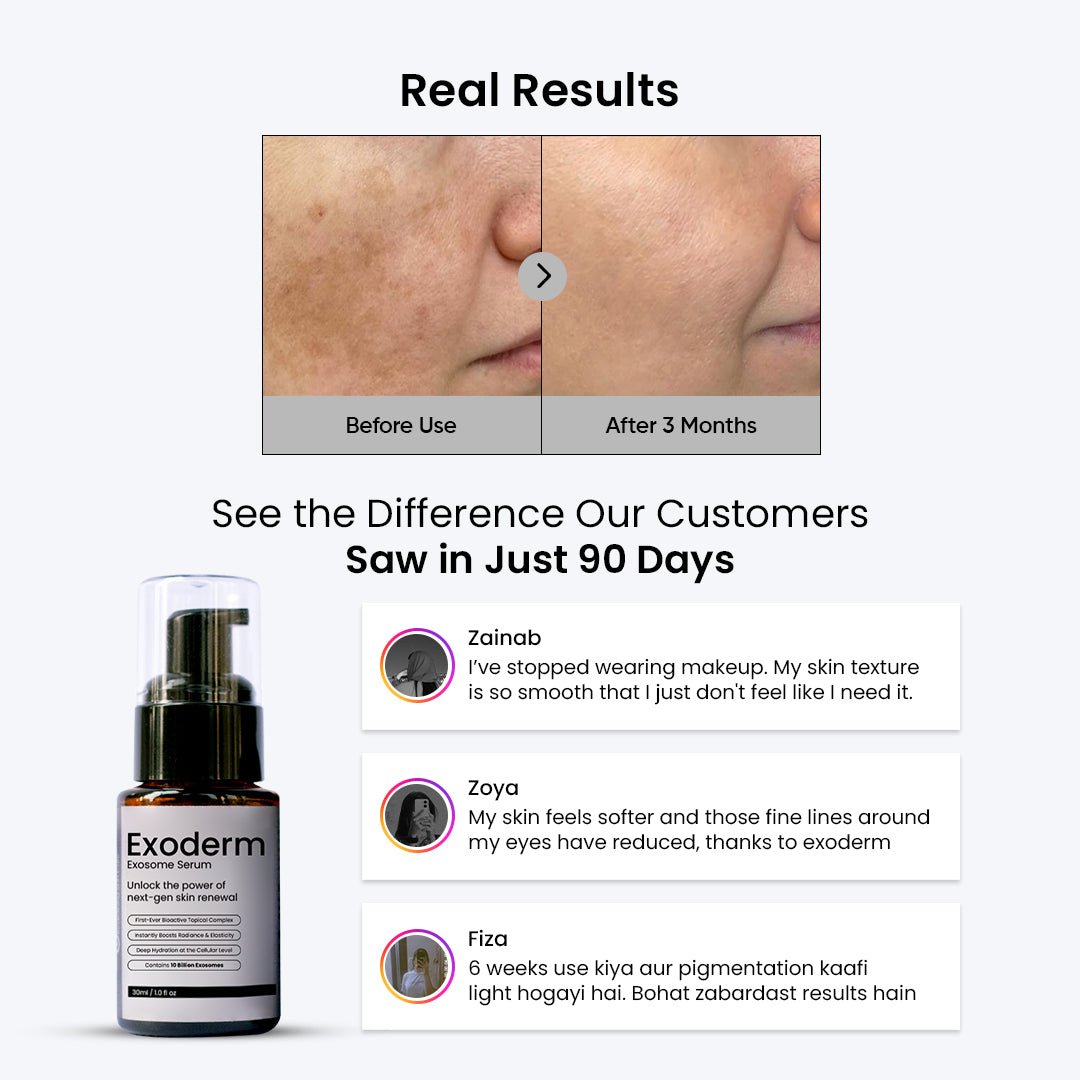 Exoderm Serum - Skin Sciences