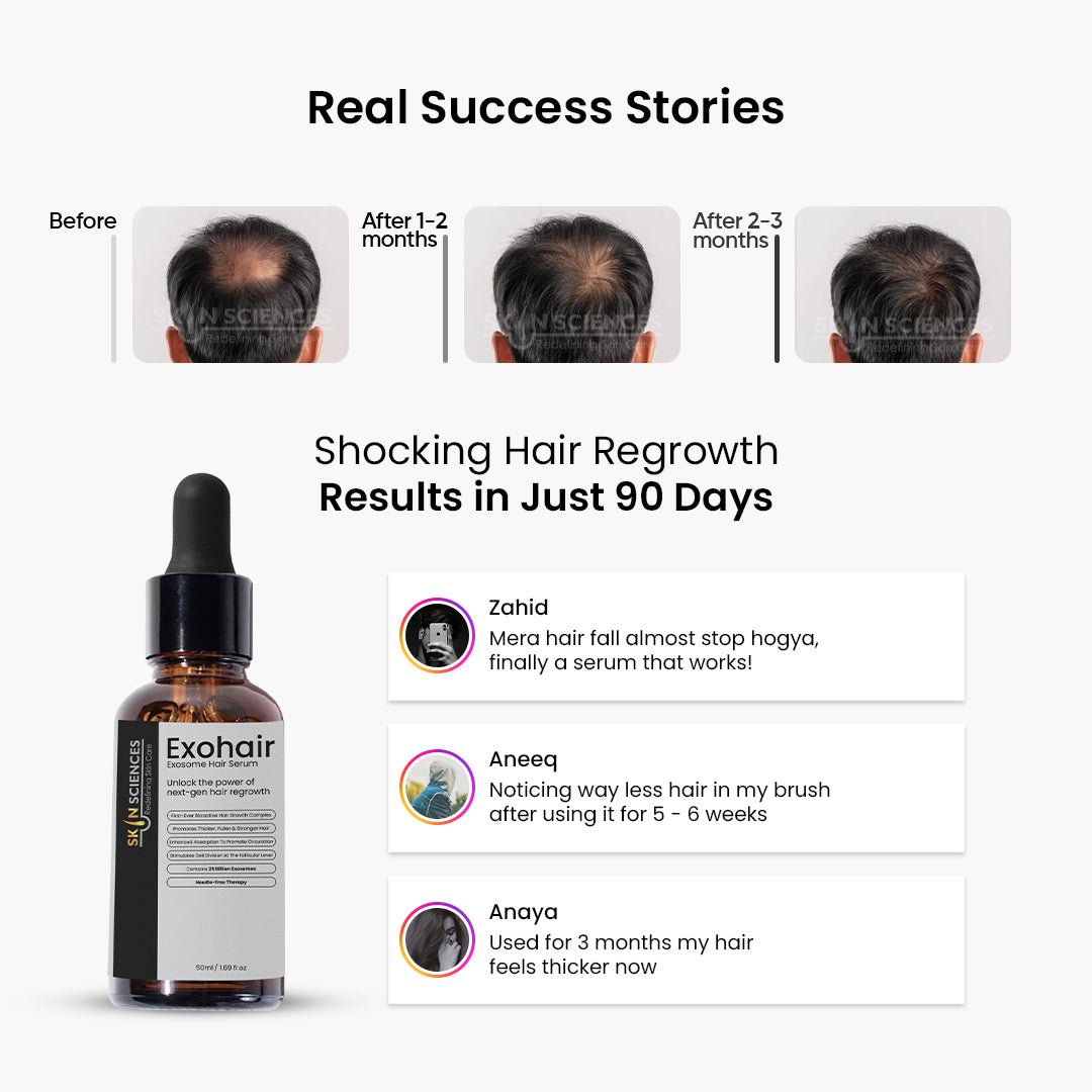 Exohair - Exosome Hair Serum - Skin Sciences