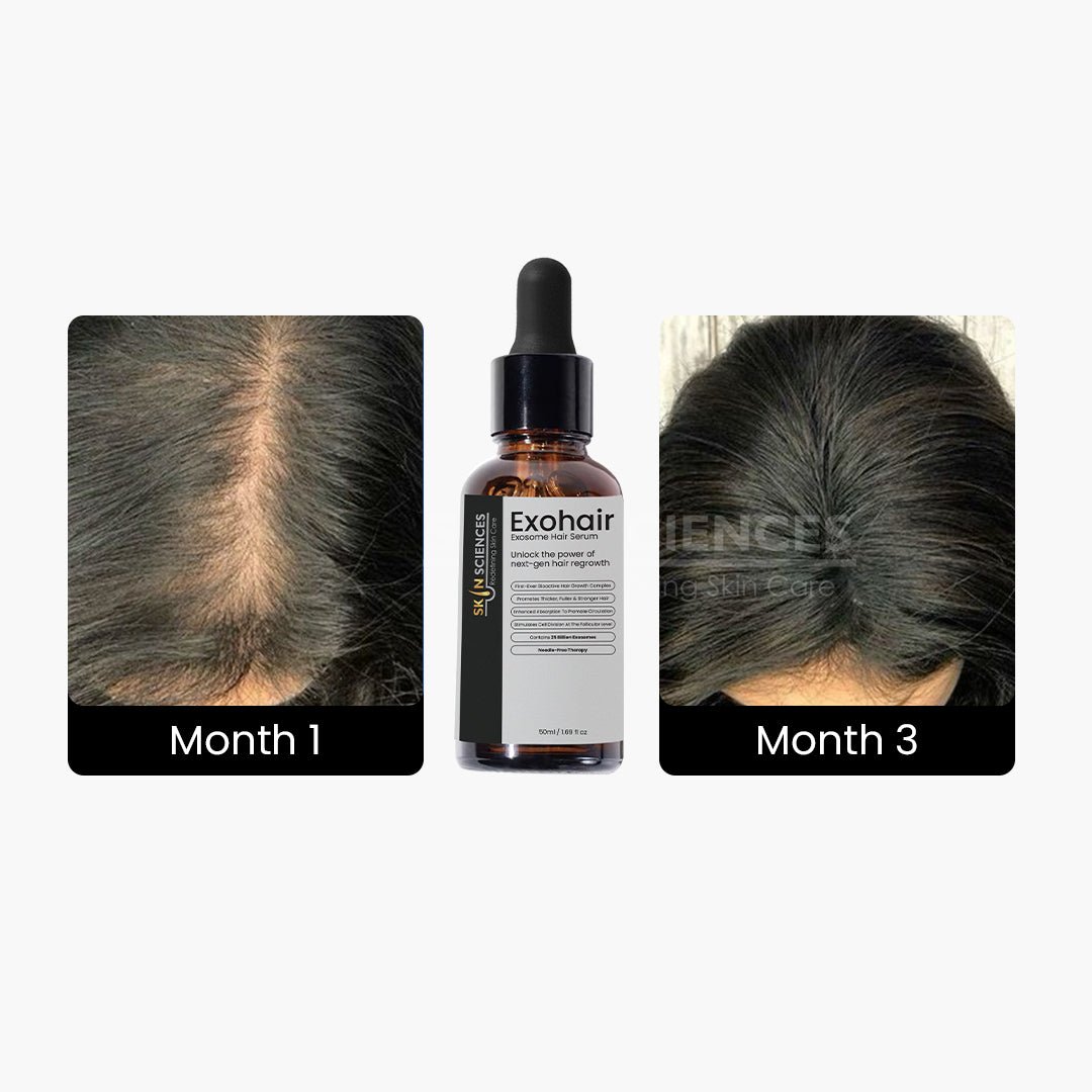 Exohair - Exosome Hair Serum - Skin Sciences