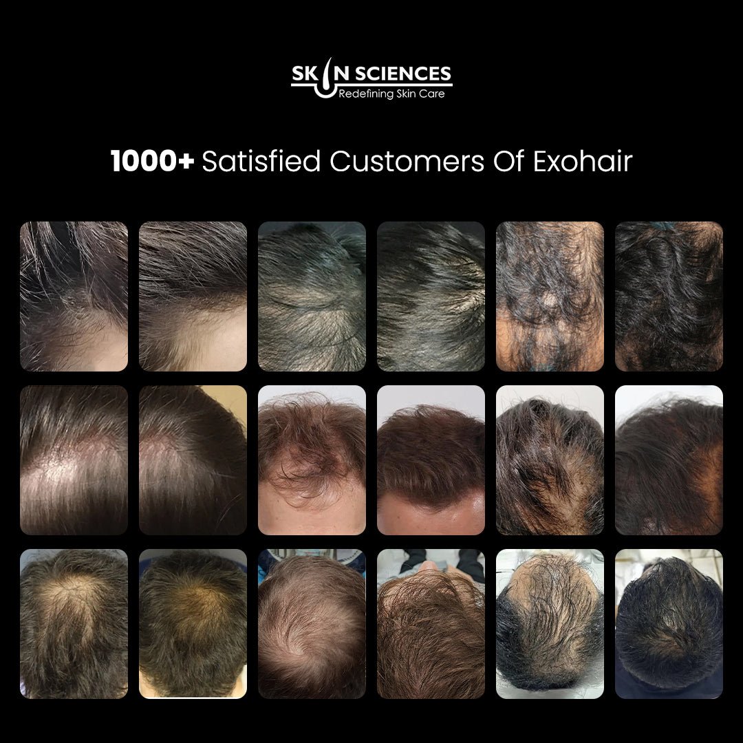 Exosome Skin & Hair Bundle - Skin Sciences
