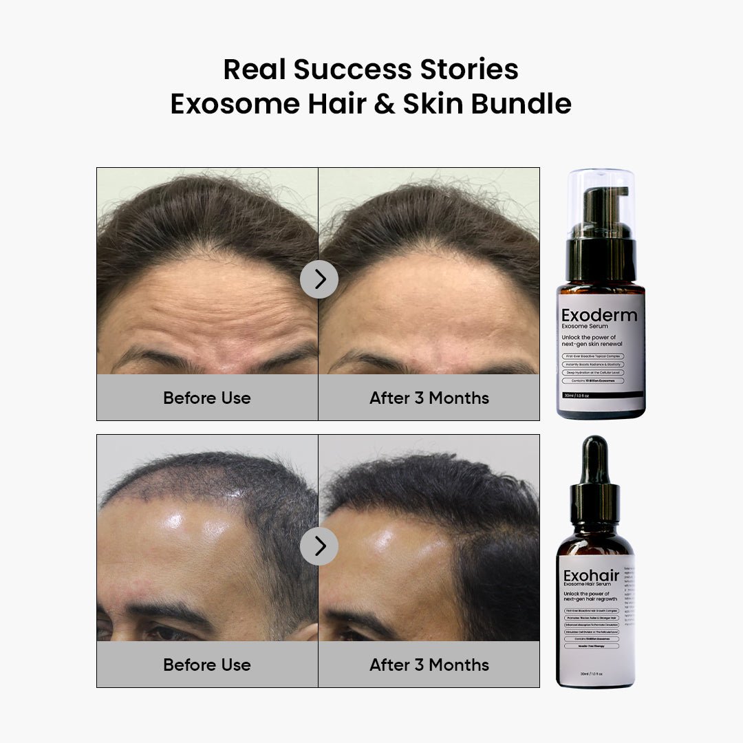 Exosome Skin & Hair Bundle - Skin Sciences