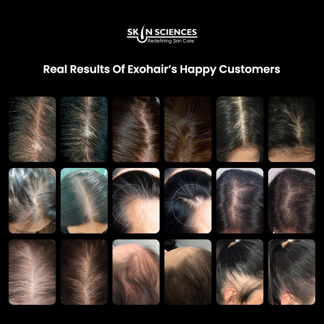 Exosome Skin & Hair Bundle - Skin Sciences