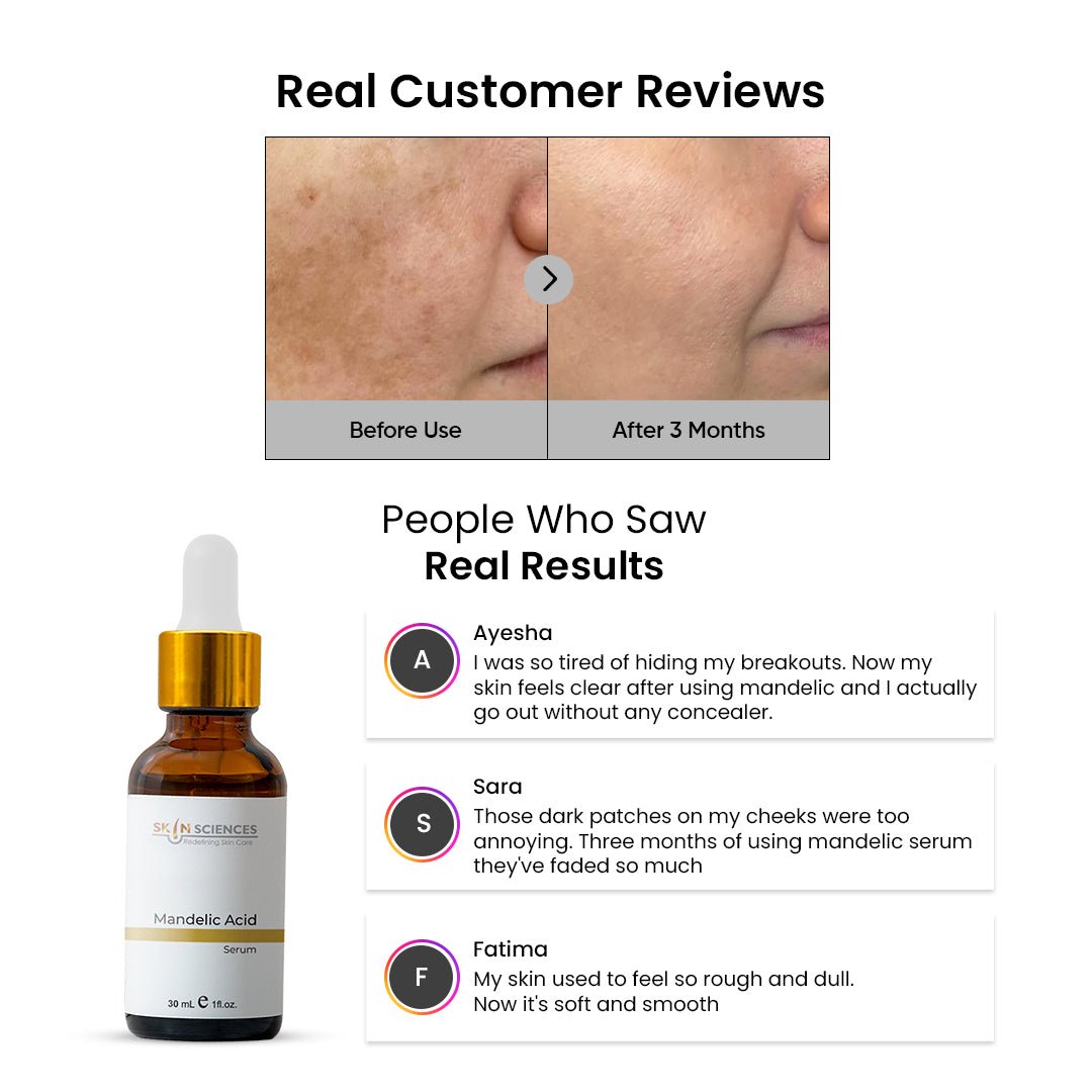 Mandelic Serum - Skin Sciences