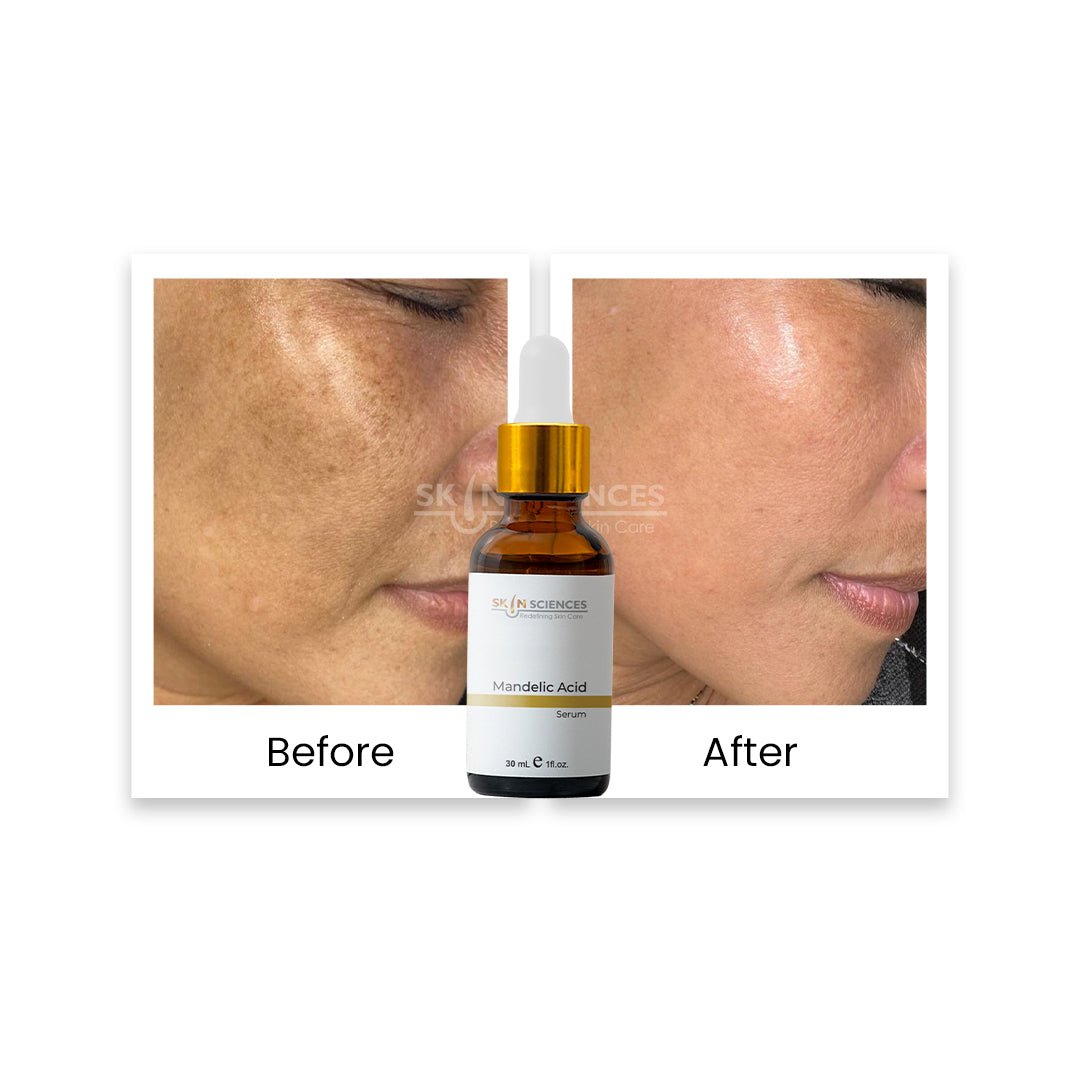 Mandelic Serum - Skin Sciences