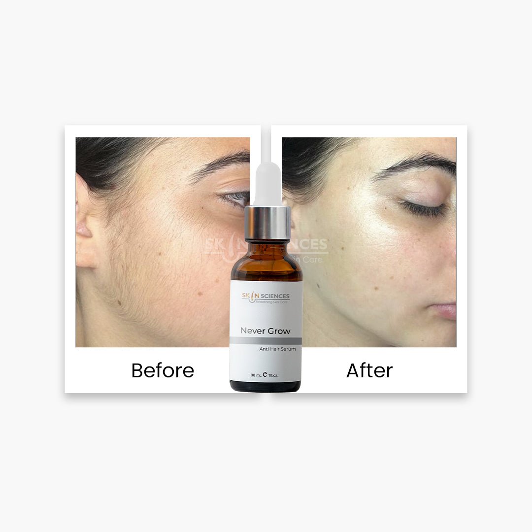 Never Grow Hair Serum - Skin Sciences