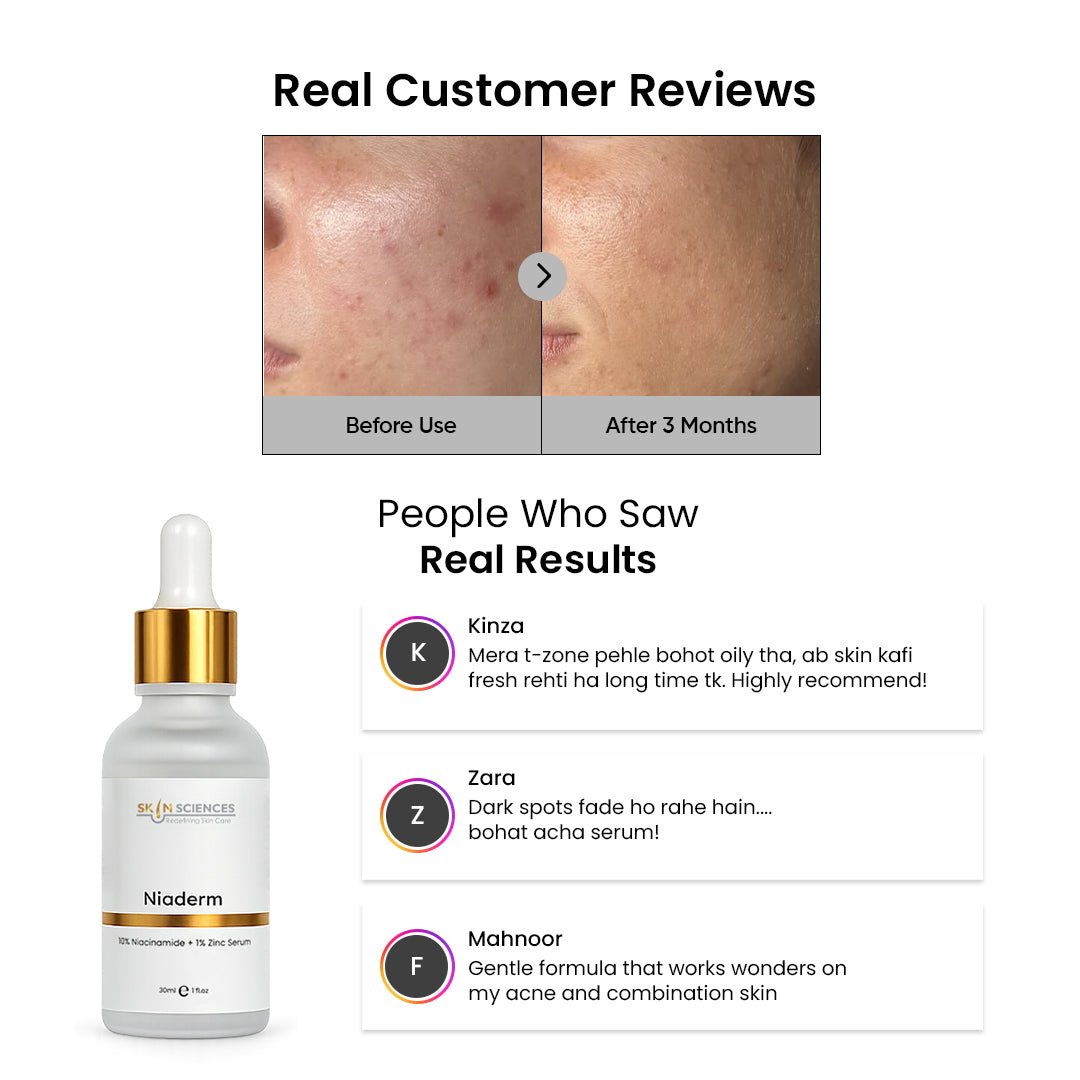 Niacinamide Serum - Skin Sciences