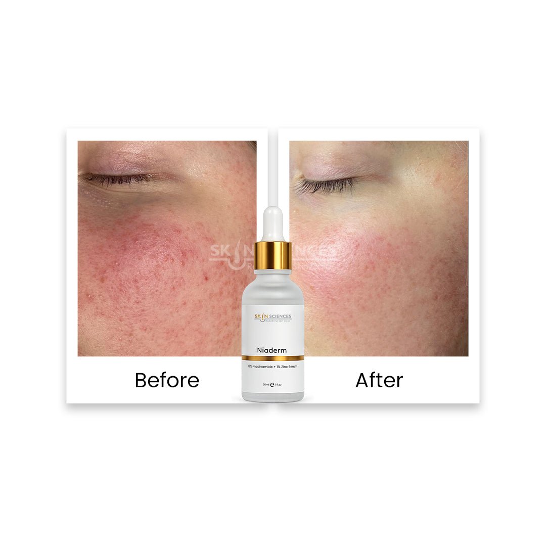 Niacinamide Serum - Skin Sciences