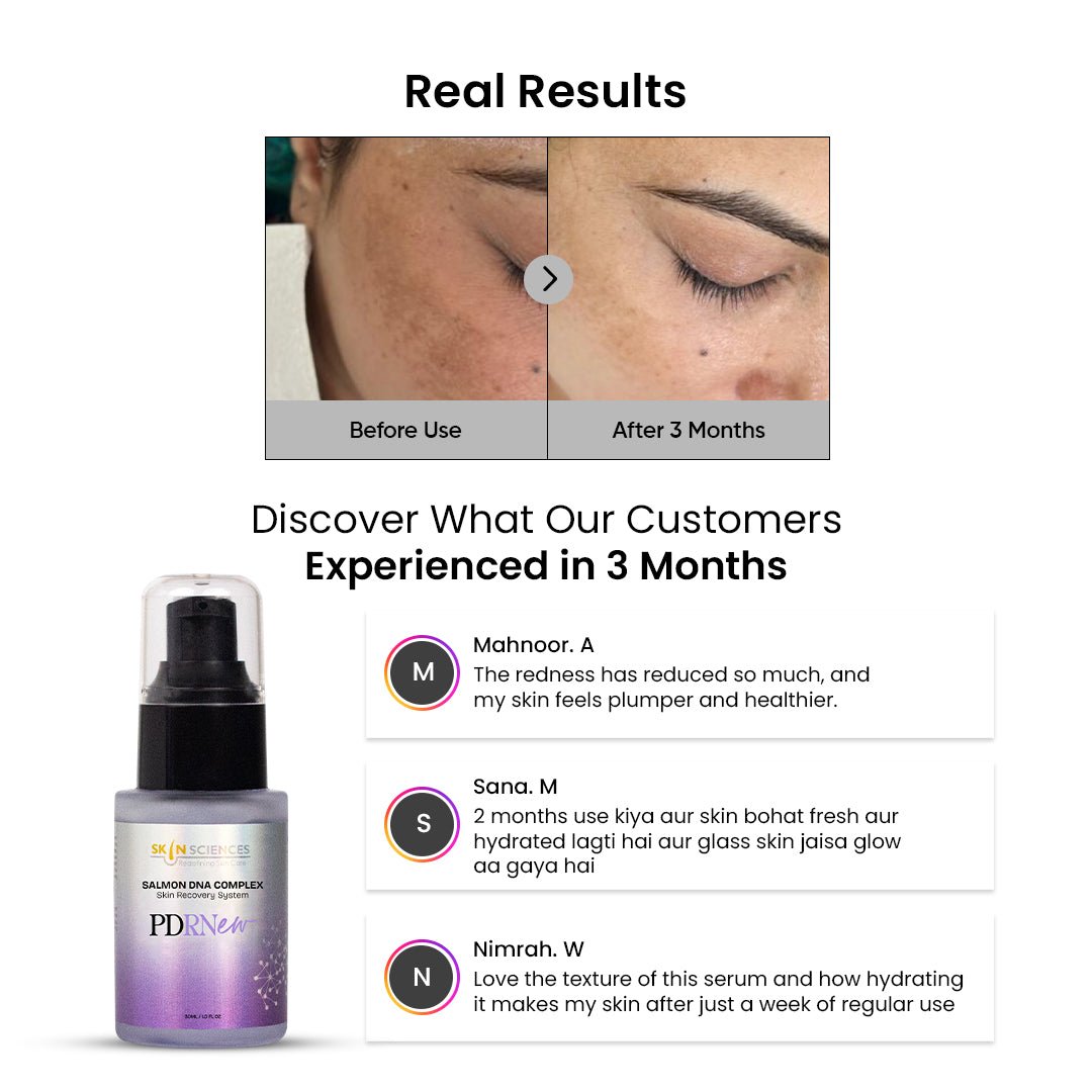 PDRNew - Salmon DNA Complex - Skin Sciences