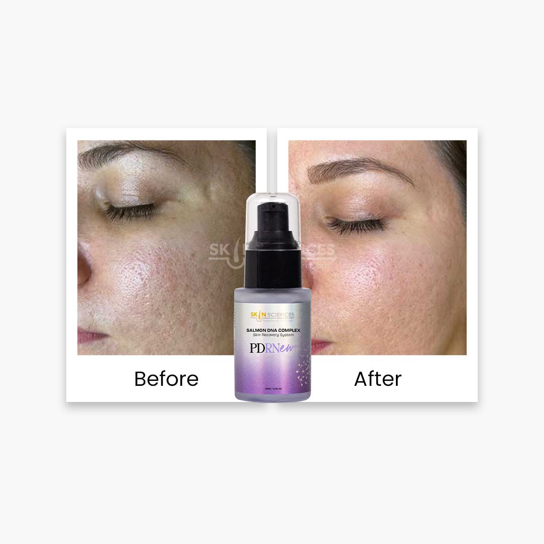 PDRNew - Salmon DNA Complex - Skin Sciences