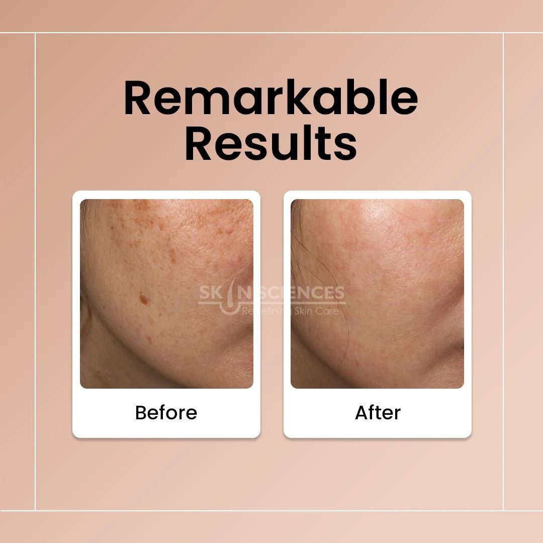 Radiance Day Cream - Skin Sciences
