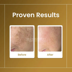 Sunblock SC Sebum Control - Skin Sciences