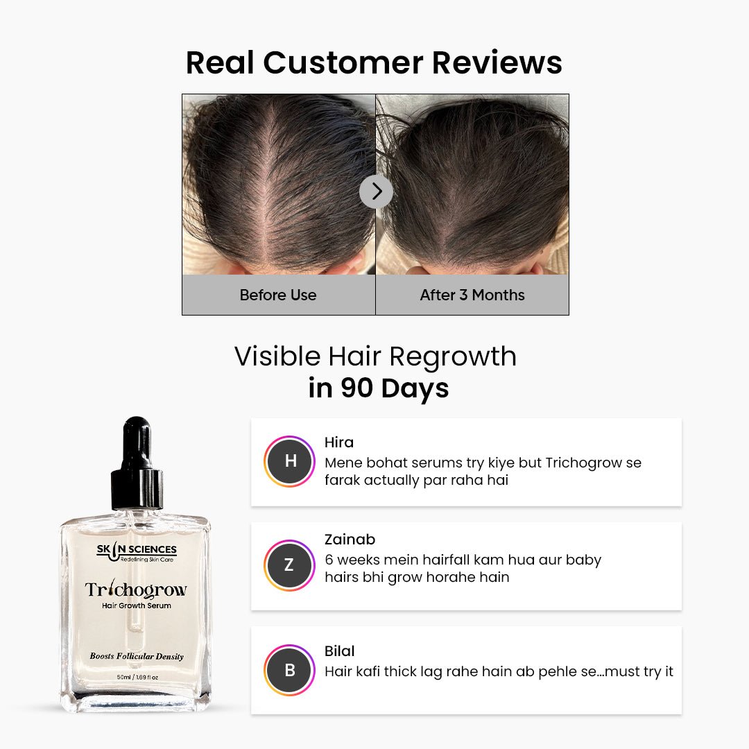 Trichogrow Serum - Hair Growth Serum - Skin Sciences