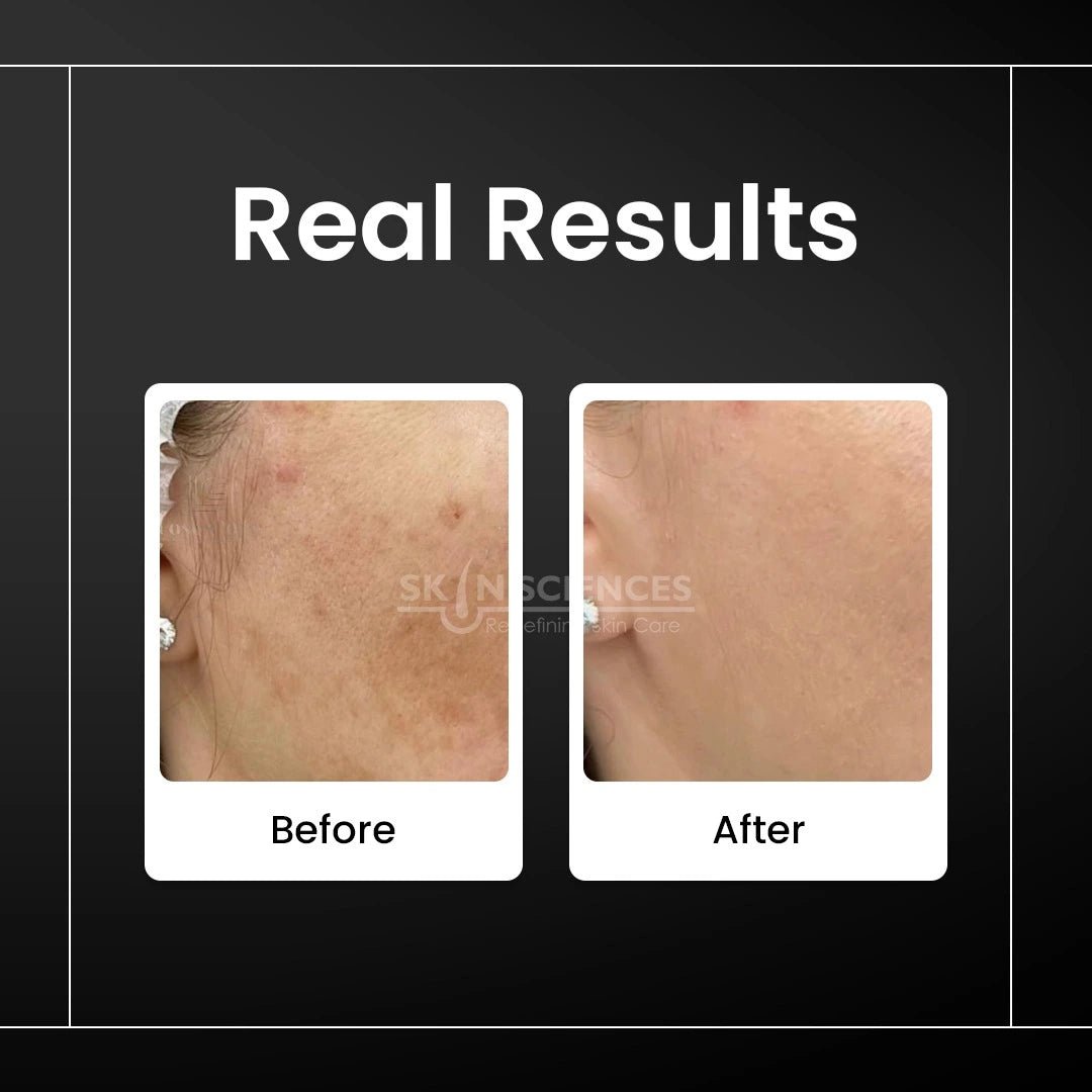 TxA Serum - Skin Sciences
