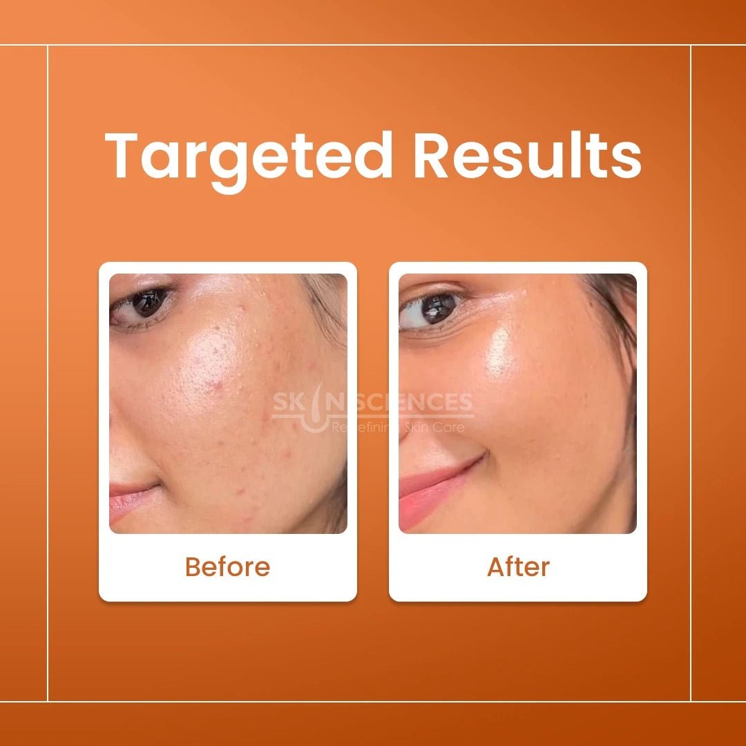 Vitamin C Serum - Skin Sciences